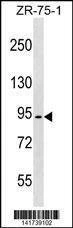 Anti-MEFV (Center) Antibody