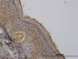 Anti-FBXO11 Antibody