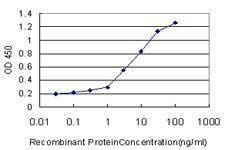 Anti-FBXO11 Antibody
