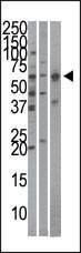Anti-Importin alpha-4 (KPNA4)Antibody (C-term) Antibody