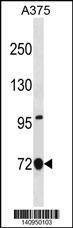 Anti-ANXA6 (C-term) Antibody