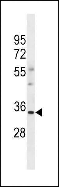 Anti-OR6S1 (C-term) Antibody