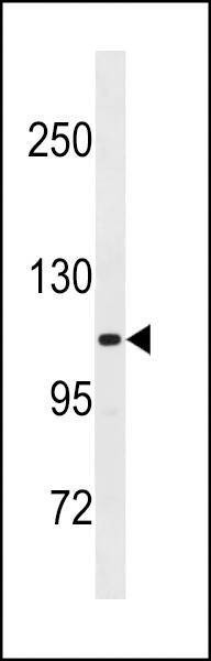 Anti-THBS4 (C-term) Antibody