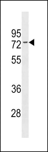 Anti-ESR1 isoform1 (N-term) Antibody