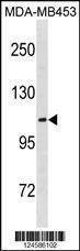 Anti-ENPP3 (C-term) Antibody