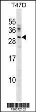 Anti-UBE2R2 (Center) Antibody