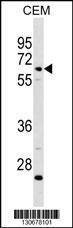 Anti-C8B (C-term) Antibody