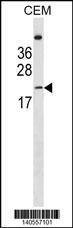 Anti-LIN7B (N-term) Antibody