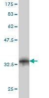 Anti-FBXO8 Antibody