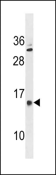 Anti-GALNTL5 (N-term) Antibody