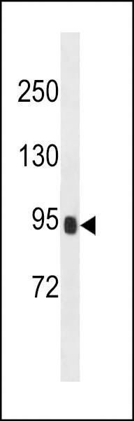 Anti-PRSS36 (Center) Antibody