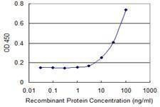 Anti-FBXW12 Antibody