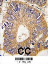 Anti-EIF4EBP1 (T69) Antibody