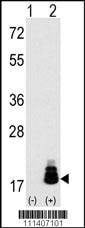 Anti-EIF4EBP1 (T69) Antibody