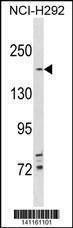 Anti-TSC2 (N-term) Antibody