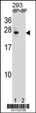 Anti-BCL2 (Center) Antibody