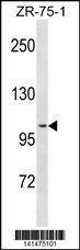 Anti-PGR (C-term) Antibody