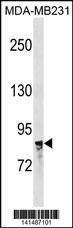 Anti-NR3C1 (C-term) Antibody