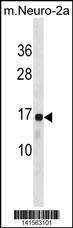 Anti-RPL22 (C-term) Antibody