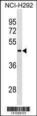 Anti-RBMY1A1 (C-term) Antibody