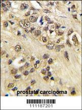 Anti-MYC (T58) Antibody