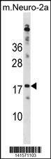 Anti-RPL30 (N-term) Antibody