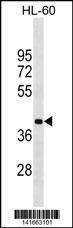 Anti-MBD2 (Center) Antibody
