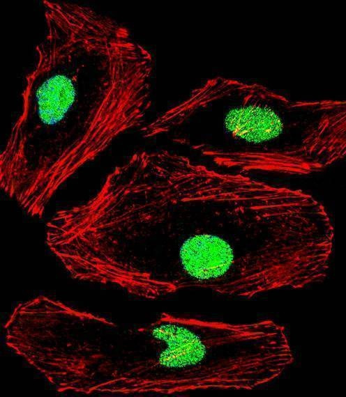 Anti-MBD2 (Center) Antibody