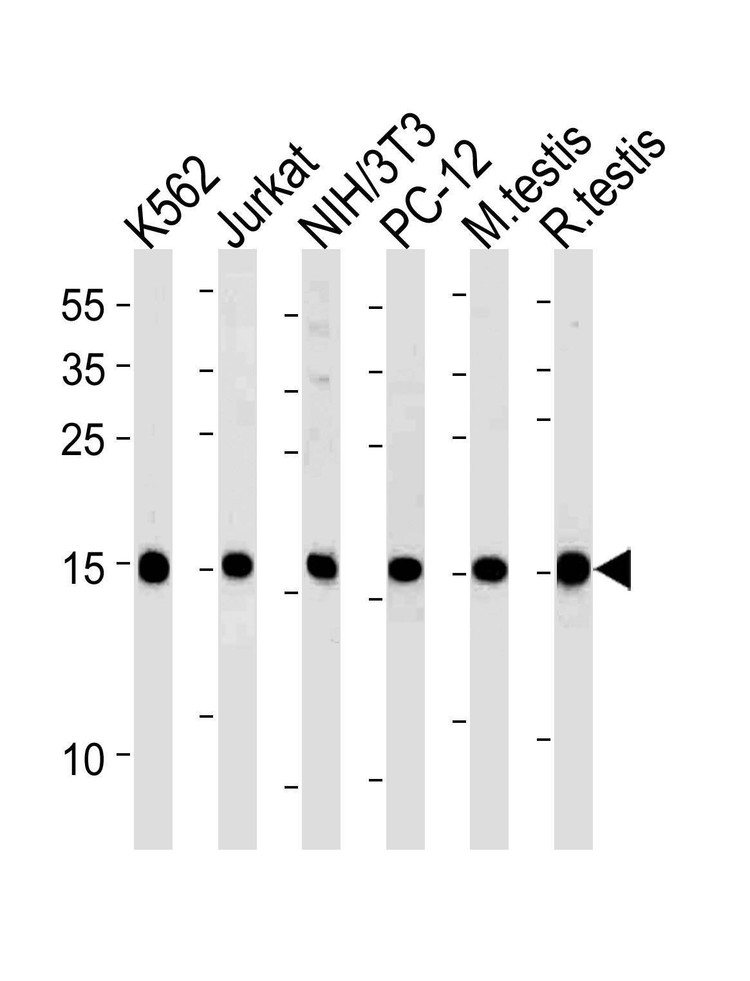 Anti-UBE2L3 (C-term) Antibody