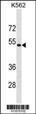 Anti-PSMD4 (C-term) Antibody