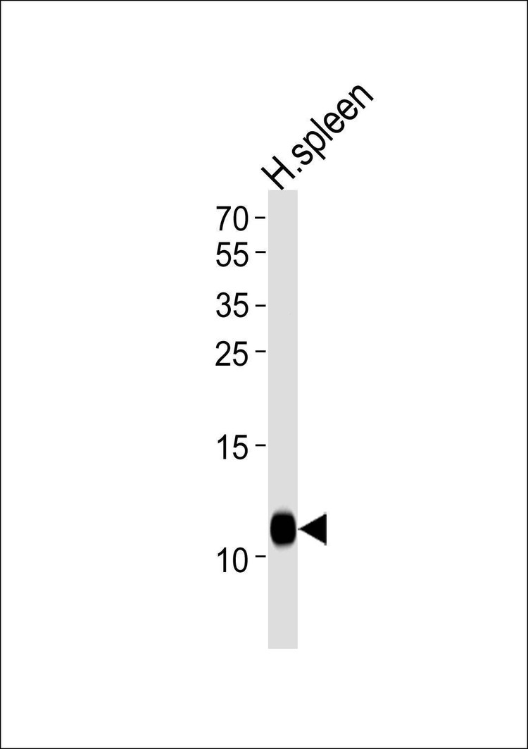 Anti-FCER1G (C-term) Antibody