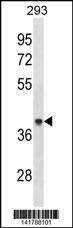 Anti-ACAA1 (Center) Antibody