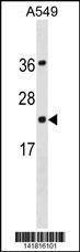 Anti-PDCD6 (N-term) Antibody