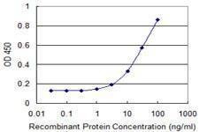 Anti-FDPS Antibody