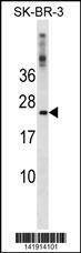 Anti-FXN (N-term) Antibody