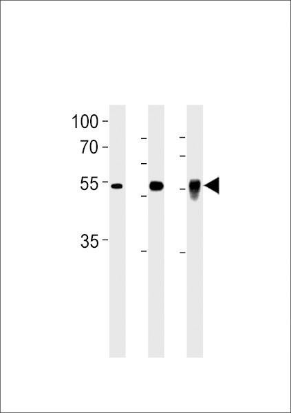 Anti-DMRTA2 (C-term) Antibody