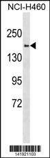 Anti-SYNJ2 (Center) Antibody