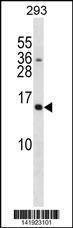 Anti-SH2D1A (C-term) Antibody
