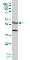 Anti-FEN1 Antibody