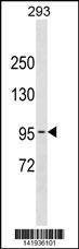 Anti-POLK (Center) Antibody