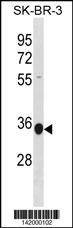 Anti-MRPL45 (C-term) Antibody