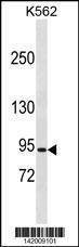 Anti-CLCN5 (N-term) Antibody