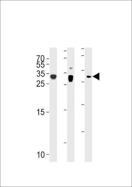 Anti-p27Kip1 (N-term S12) Antibody