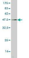 Anti-FGF12 Antibody
