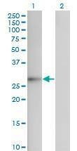Anti-FGF12 Antibody