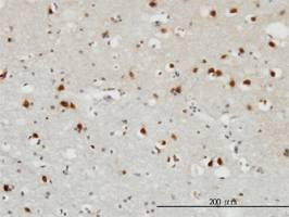 Anti-FGF12 Antibody