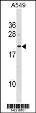 Anti-BLVRB (Center) Antibody
