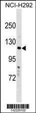 Anti-HPS5 (N-term) Antibody
