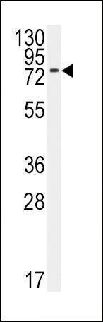 Anti-BMPR1A (N-term K36) Antibody