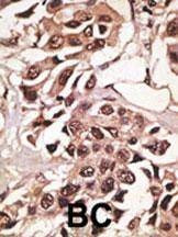 Anti-BMPR1A (N-term K36) Antibody